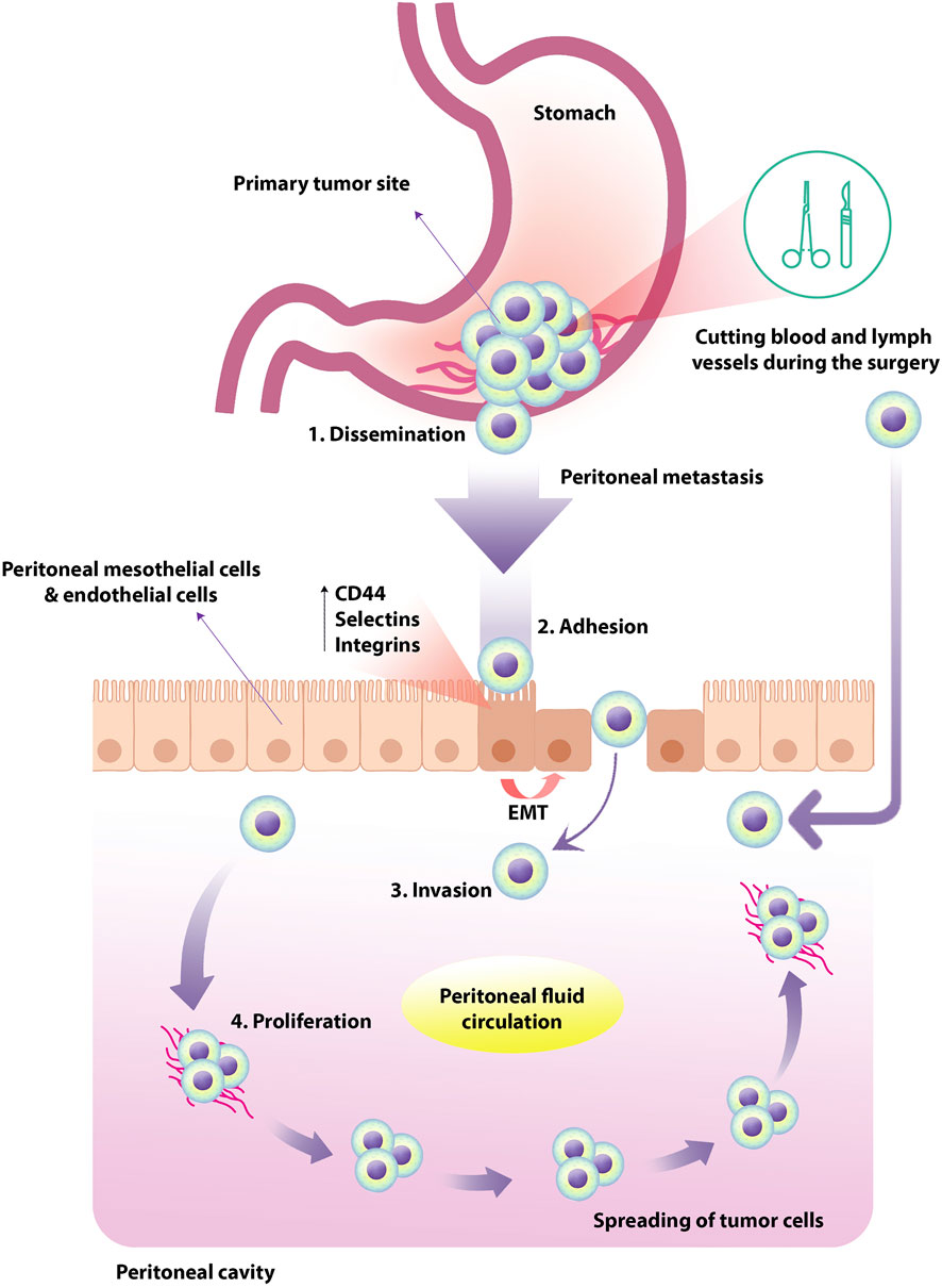 frontiers-oncolytic-virotherapy-in-peritoneal-metastasis-gastric