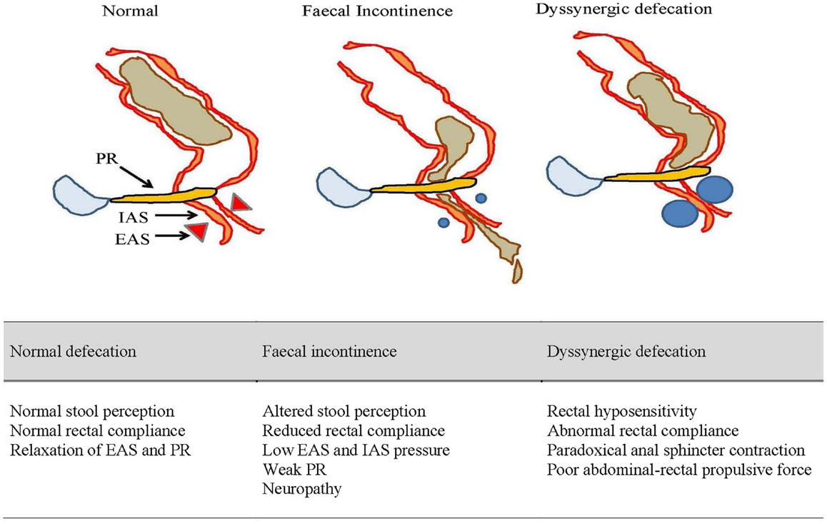 Difference between sperm and pee