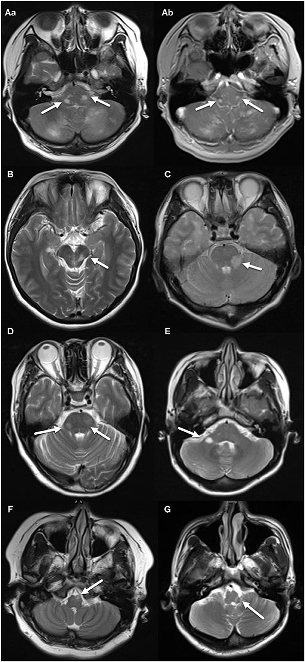 Imaging Surrogates of Disease Activity in Neuromyelitis Optica Allow Distinction from Multiple Sclerosis