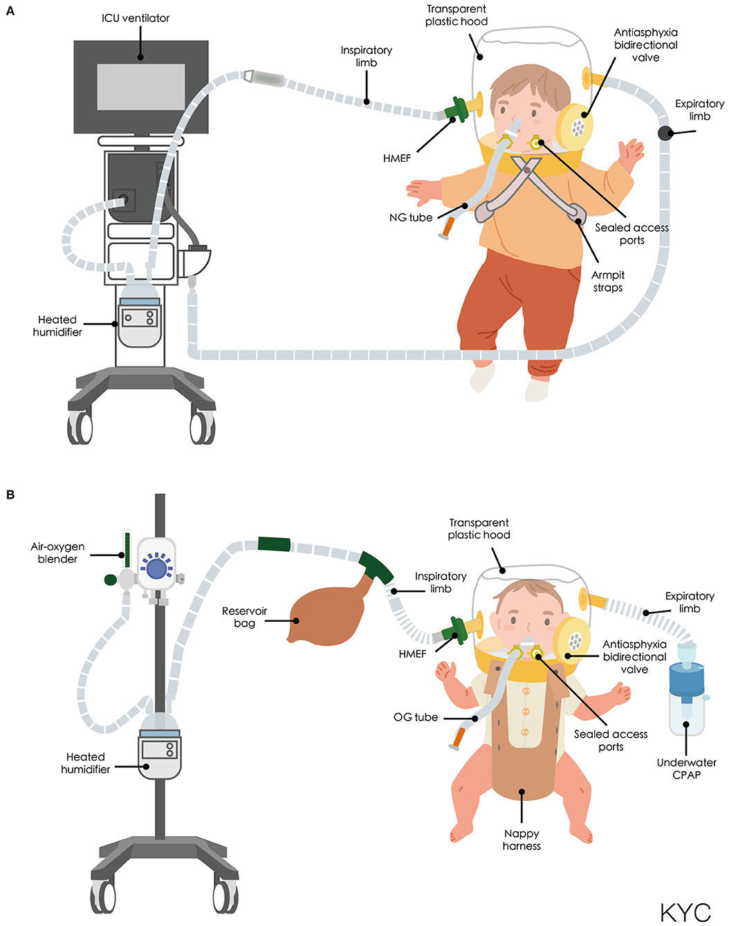 Frontiers Helmet Ventilation for Pediatric Patients During the COVID