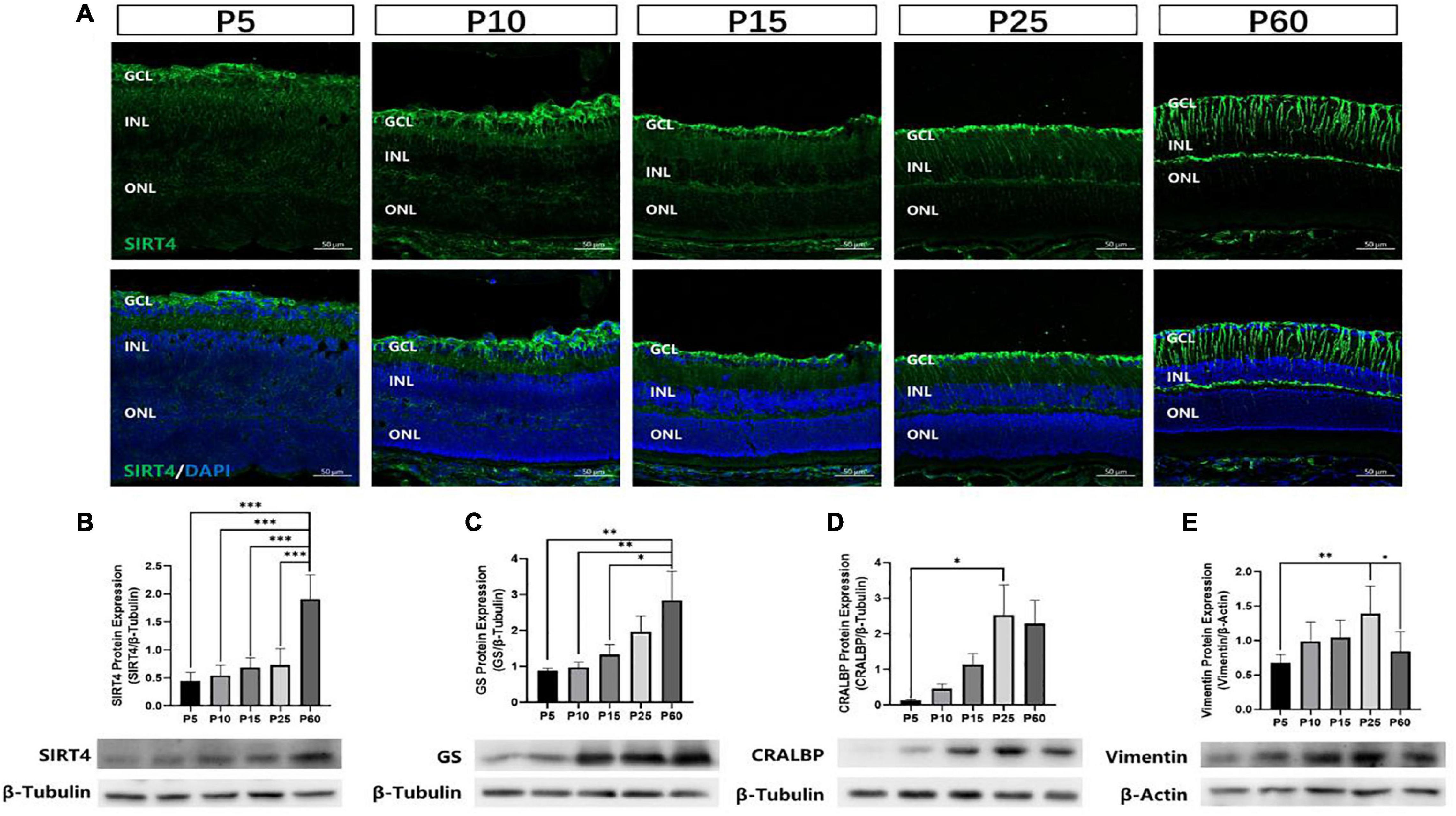 Frontiers | SIRT4 Is Highly Expressed in Retinal Müller