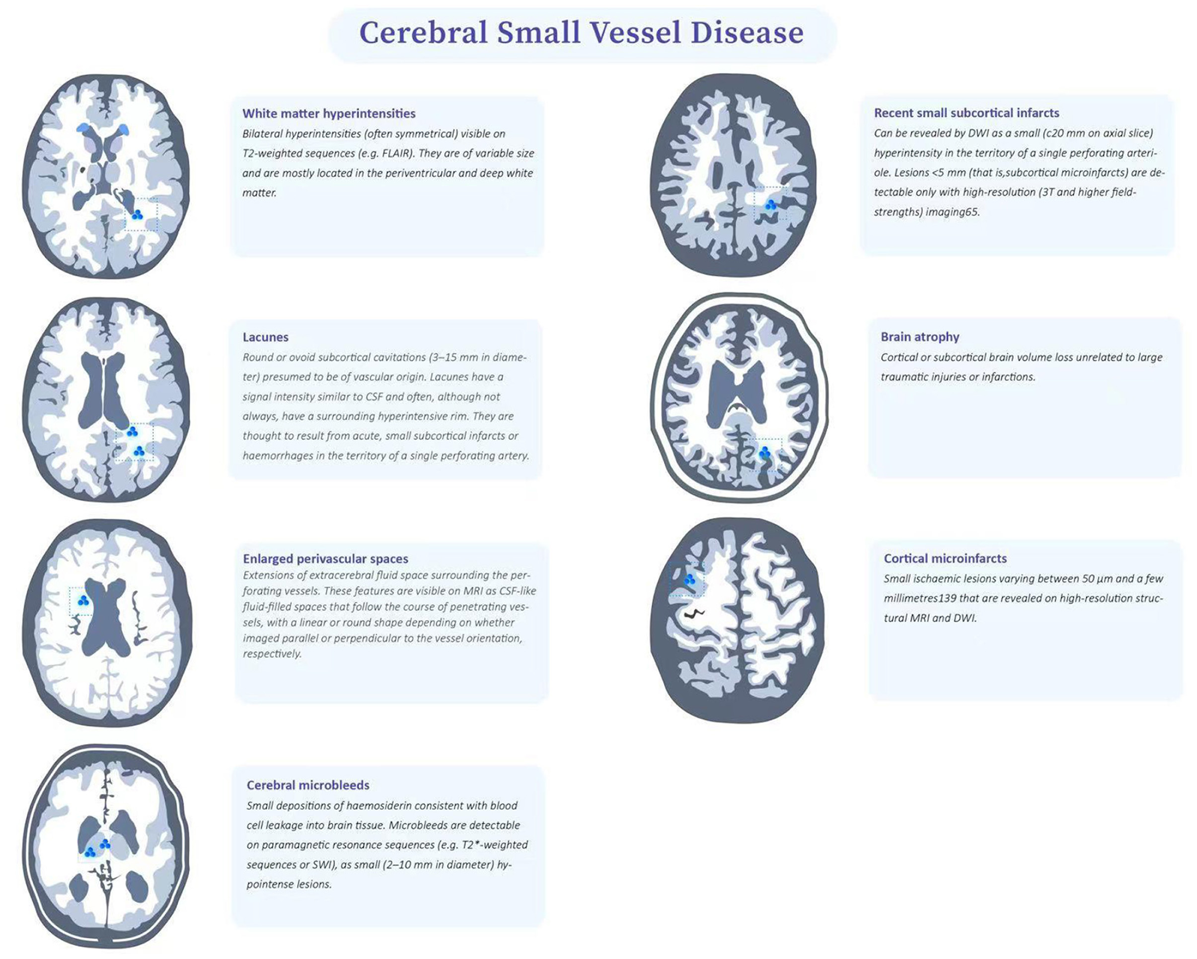 Frontiers | Clinical, and Pathological Characteristics Cerebral Small Vessel Disease Multiple A Review