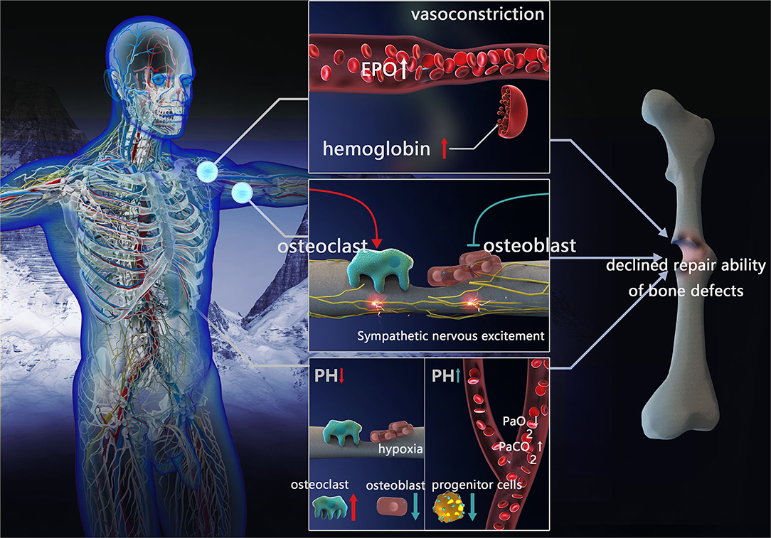 Frontiers  Impact of High-Altitude Hypoxia on Bone Defect Repair