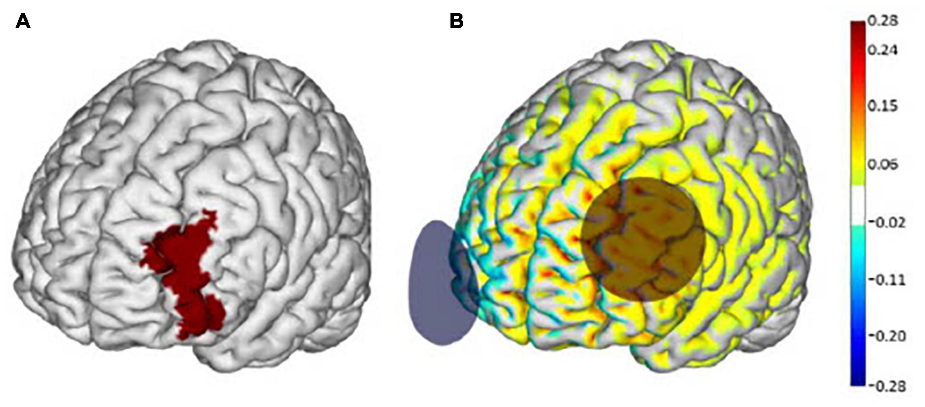 Frontiers  Differential tDCS and tACS Effects on Working Memory-Related  Neural Activity and Resting-State Connectivity