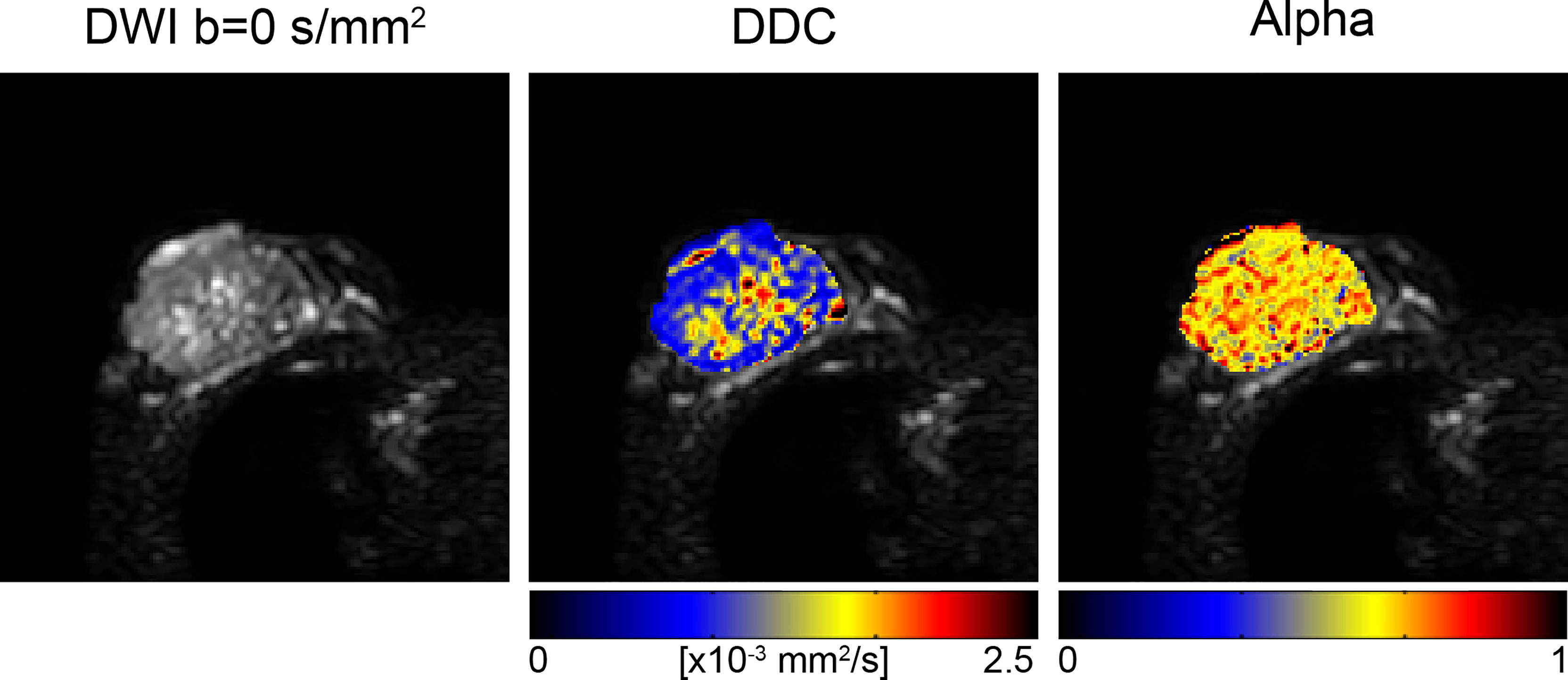 ADC values (mm2/s) of tumor and liver at different time points.