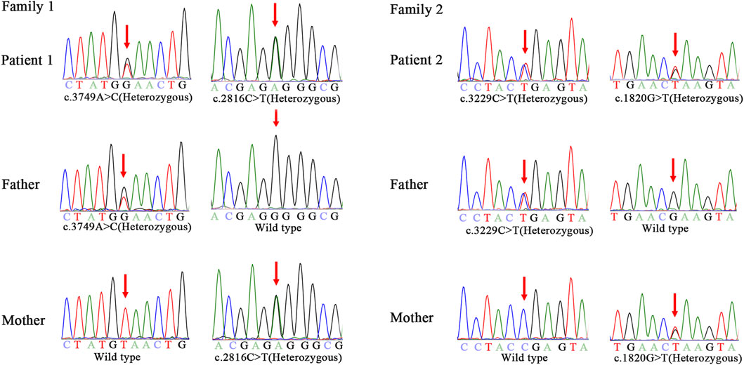 Niemann-Pick disease type C-presenting as persistent neonatal jaundice: a  rare case report