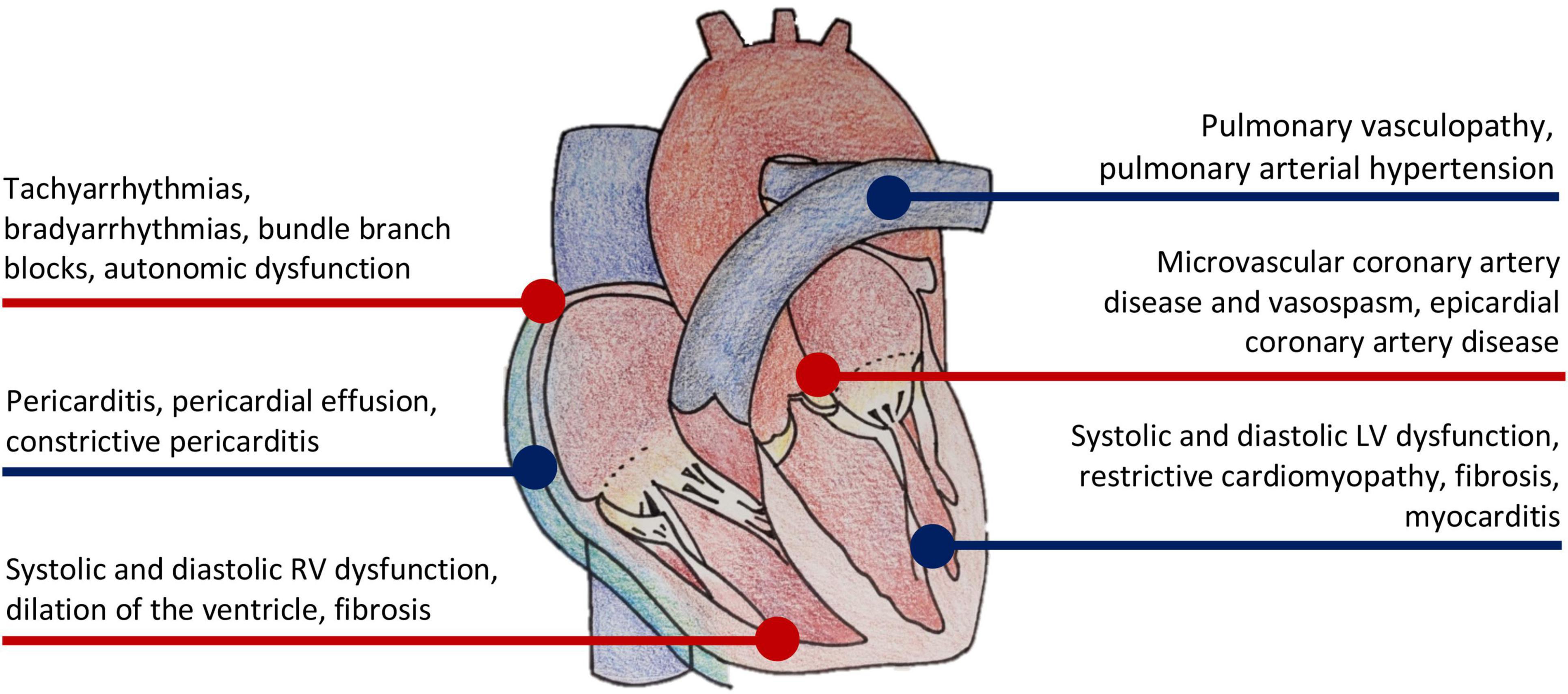 Progression of Left Ventricular Myocardial Dysfunction in Systemic  Sclerosis: A Speckle-tracking Strain Echocardiography Study