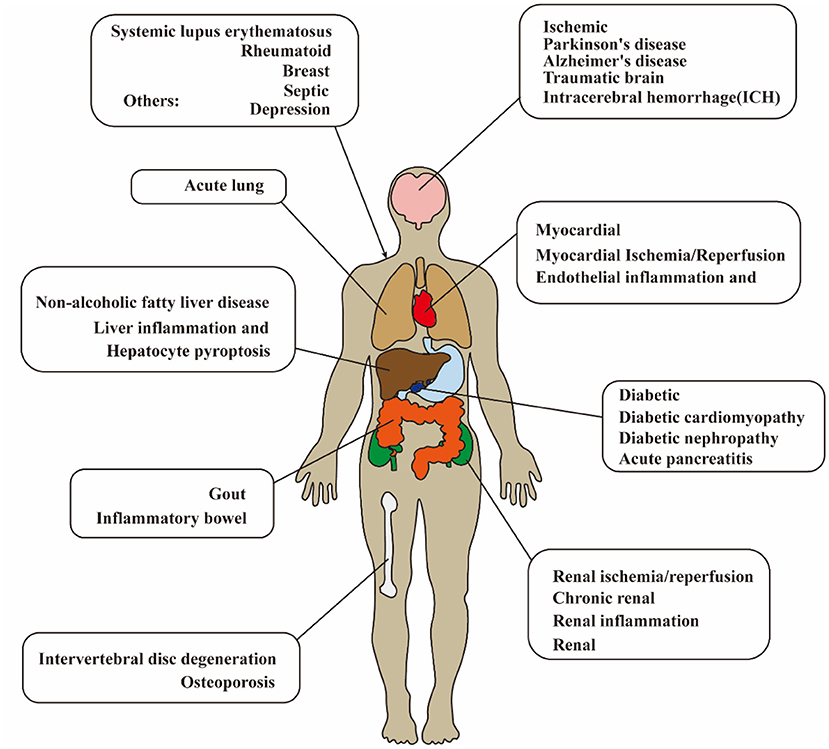 Therapeutic modulation of inflammasome pathways - Chauhan - 2020
