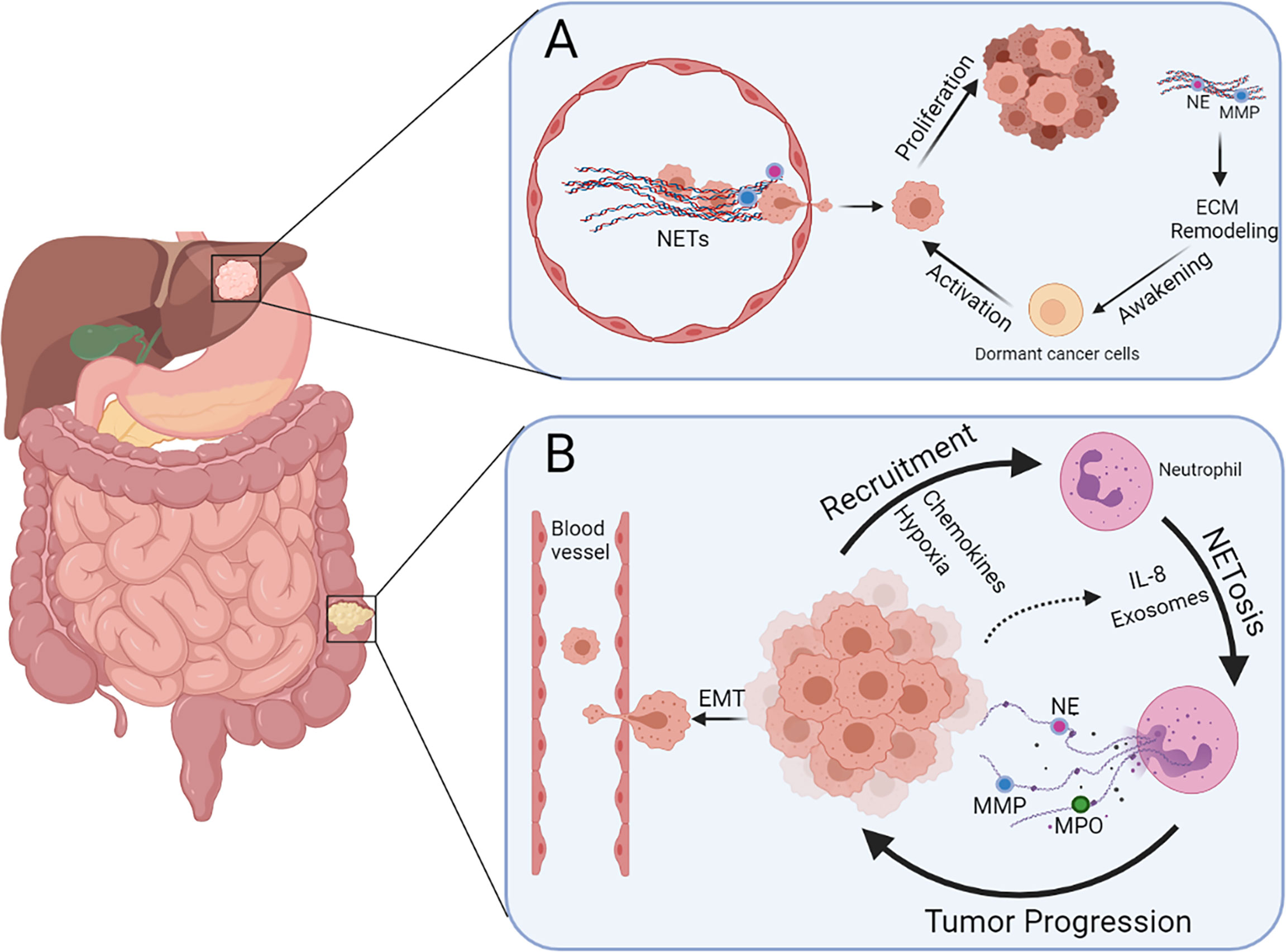 Frontiers  The implication of neutrophil extracellular traps in  nonalcoholic fatty liver disease