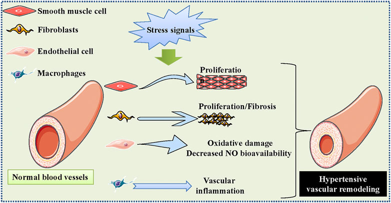 Attenuation of hypertension by C-fiber stimulation of the human