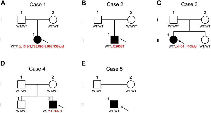 Pediatric on Squares on X: Rubinstein Taybi Syndrome #Pediatric