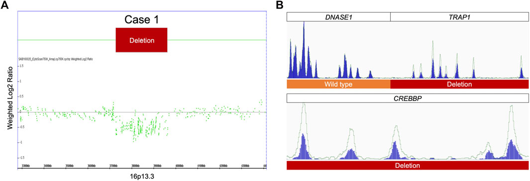 The behavioral phenotype of Rubinstein–Taybi syndrome: A scoping review of  the literature - Awan - 2022 - American Journal of Medical Genetics Part A  - Wiley Online Library