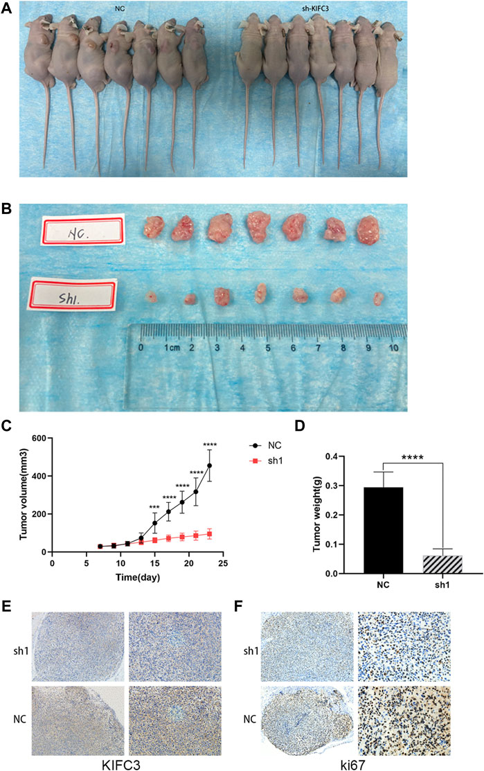 Frontiers | KIFC3 Promotes Proliferation, Migration, and Invasion in ...