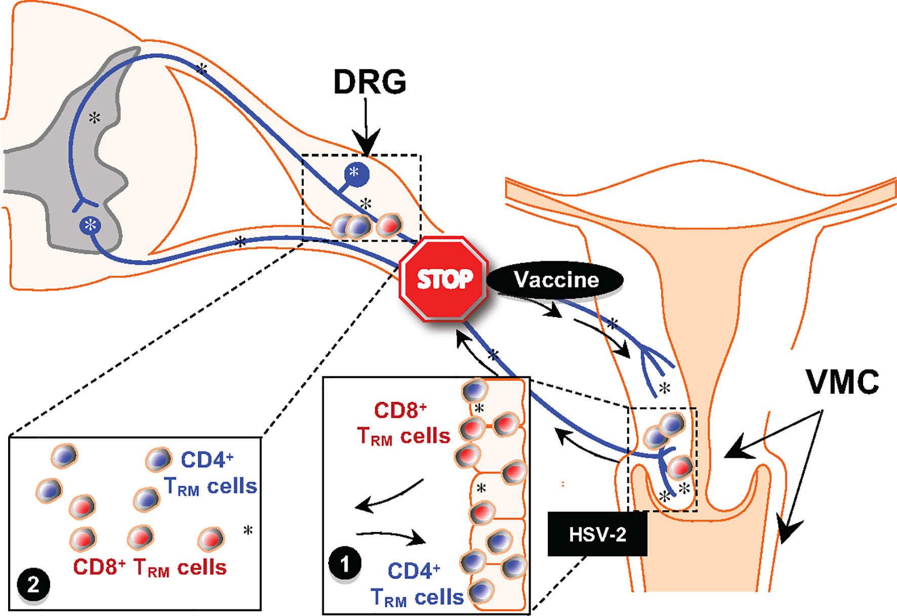 Herpes Simplex virus 1/2 IGG. Anti - HSV (2 Тип) IGG. HSV-2. Herpes Simplex virus 1 IGG. Herpes simplex 1 2 igg