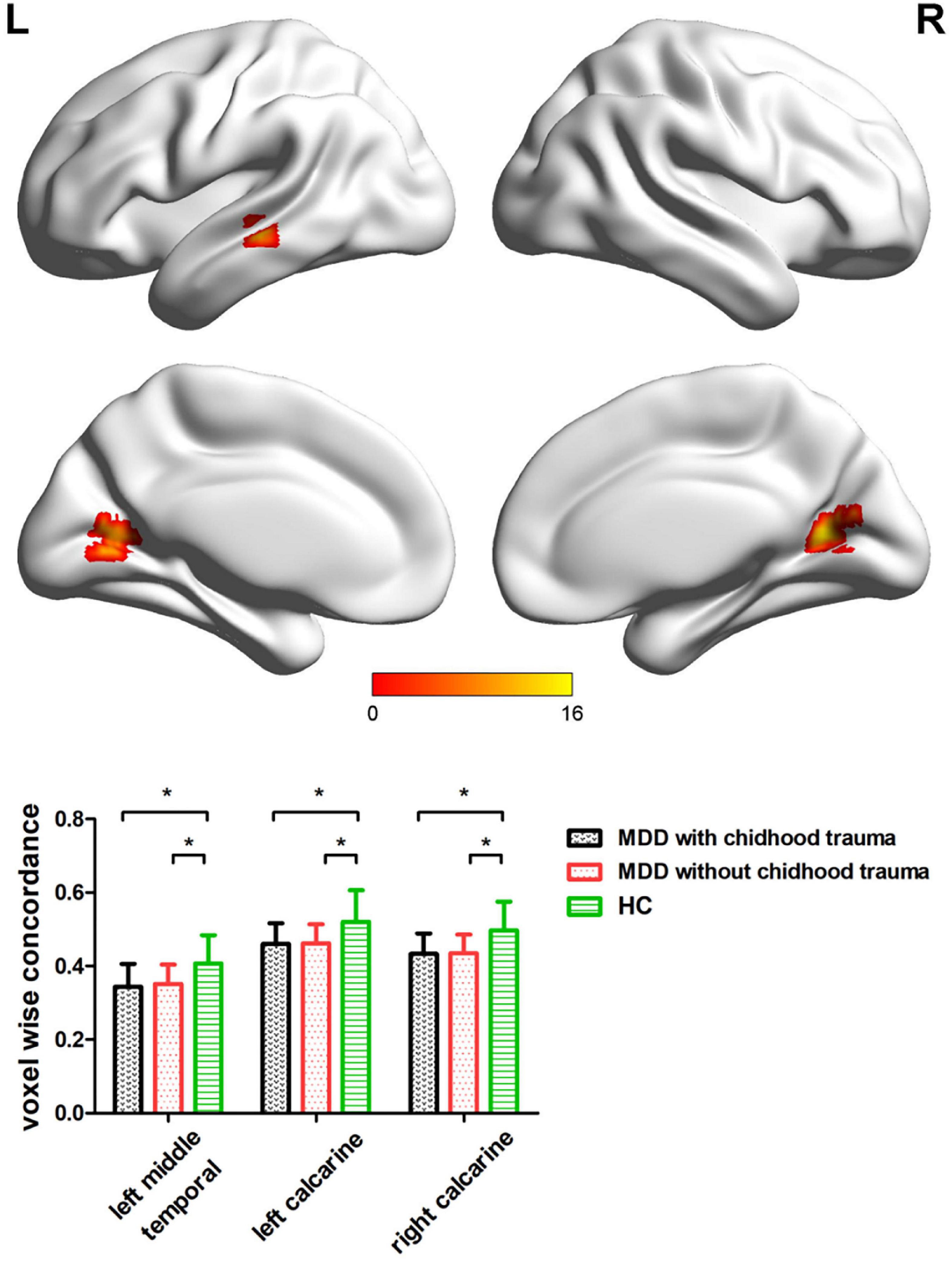 Frontiers  Neural activity in adults with major depressive disorder  differs from that in healthy individuals: A resting-state functional  magnetic resonance imaging study