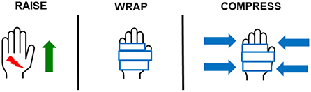 Figure 1 - Three tips to help stop bleeding.