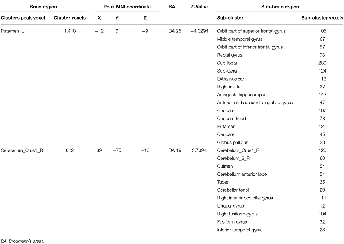 PDF] Premenstrual syndrome, a common but underrated entity: review of the  clinical literature