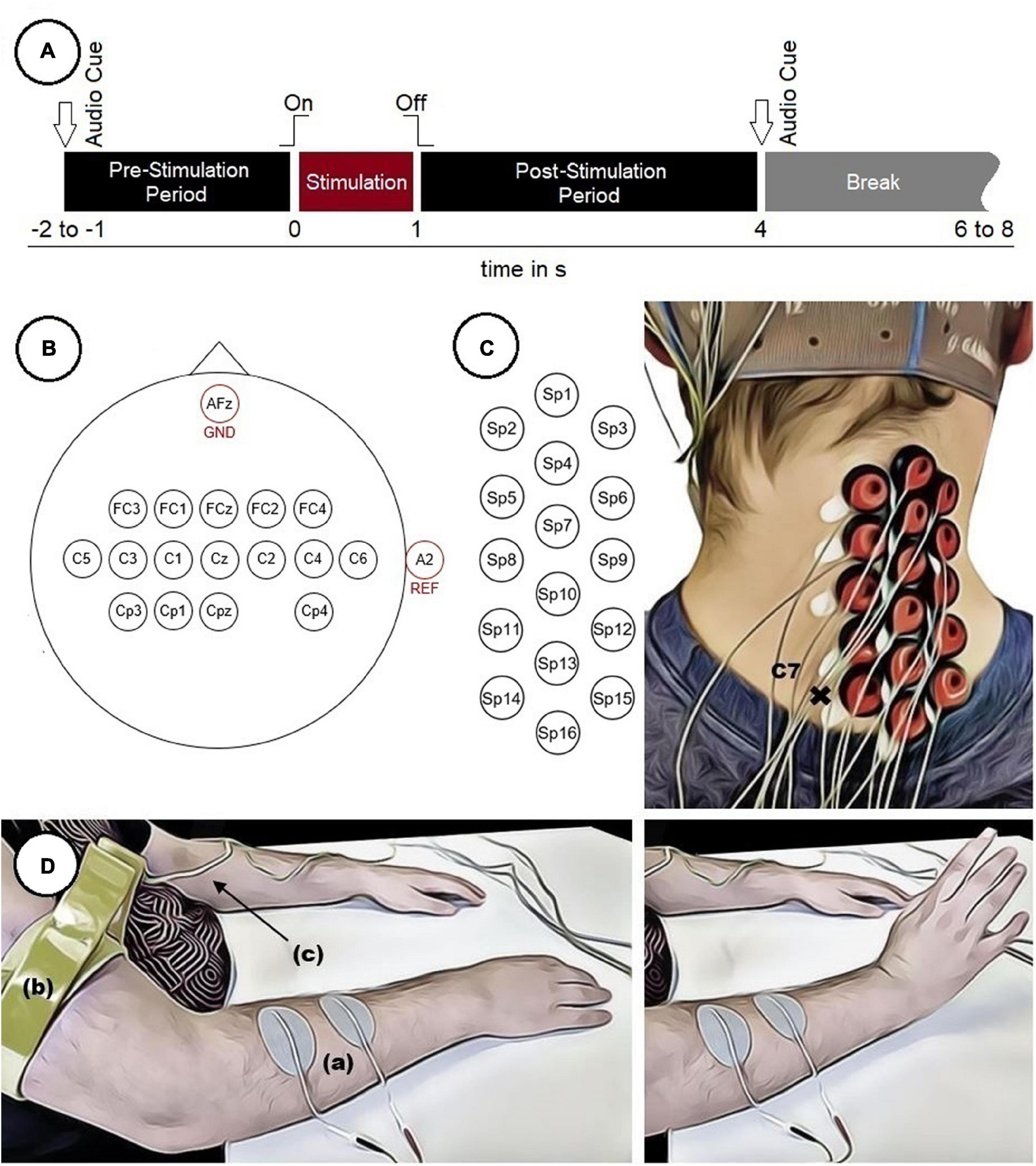 Acute effects of neuromuscular electrical stimulation on cortical dynamics  and reflex activation