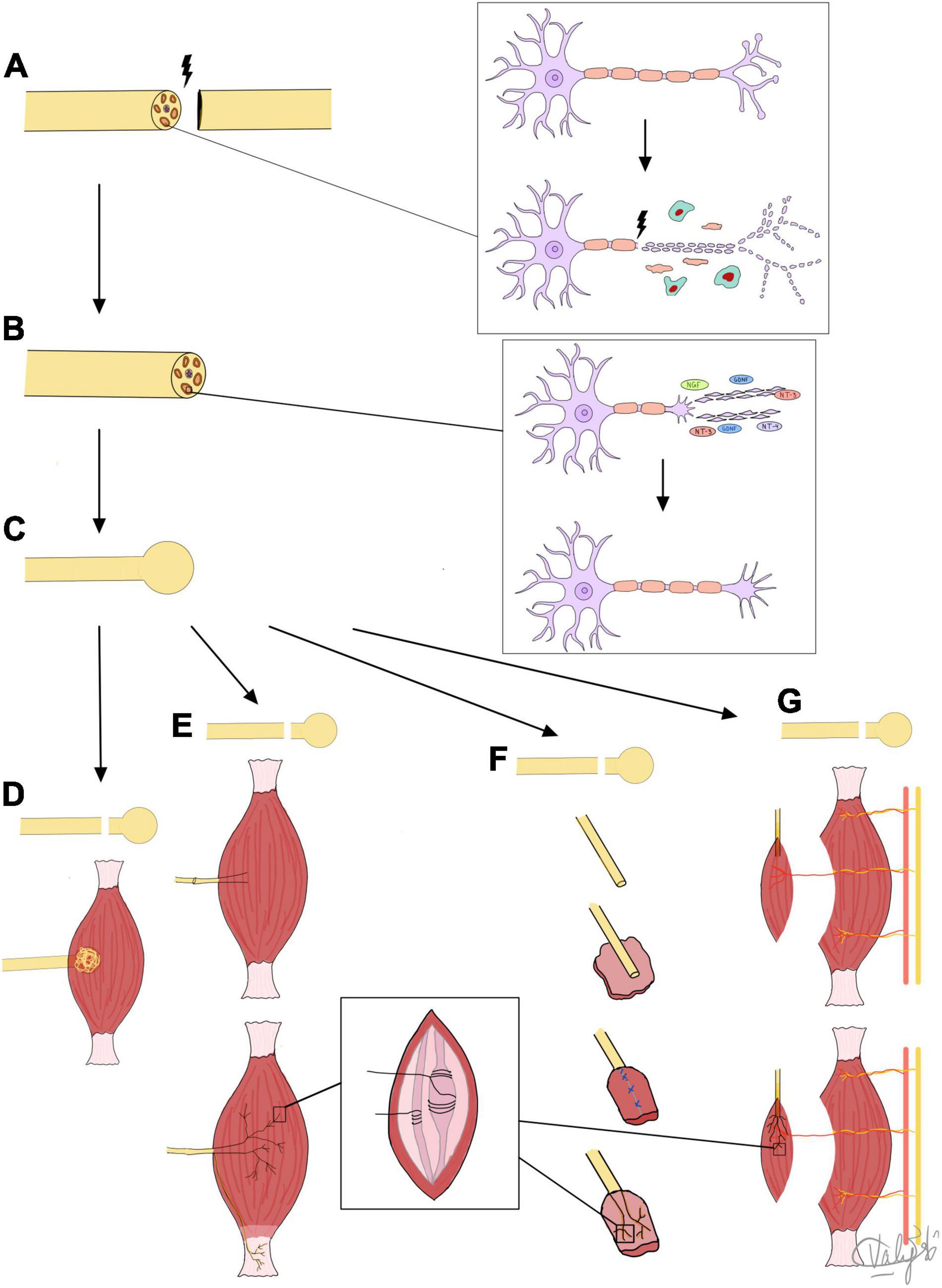 after axonal injury regeneration in peripheral nerves is guided by