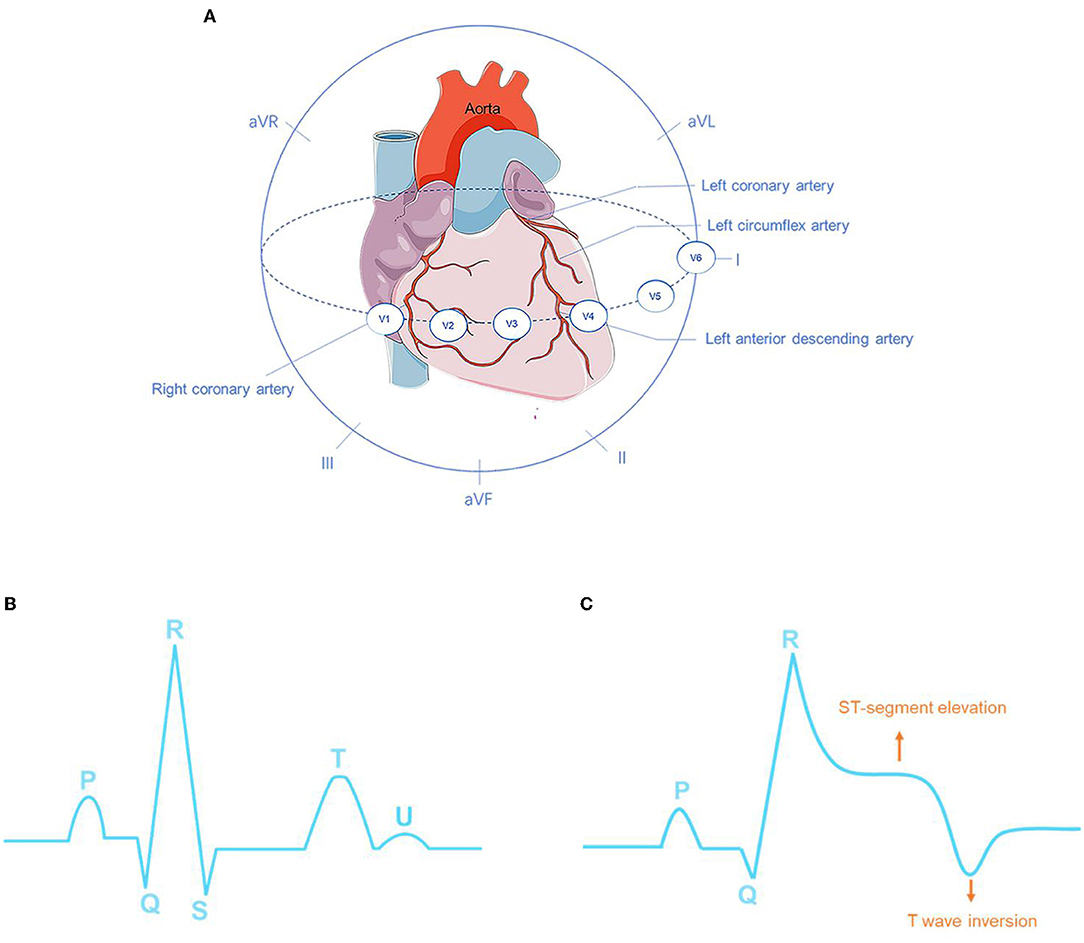 AI Accurately Detects LV Dysfunction Using Single-Lead Apple Watch ECG