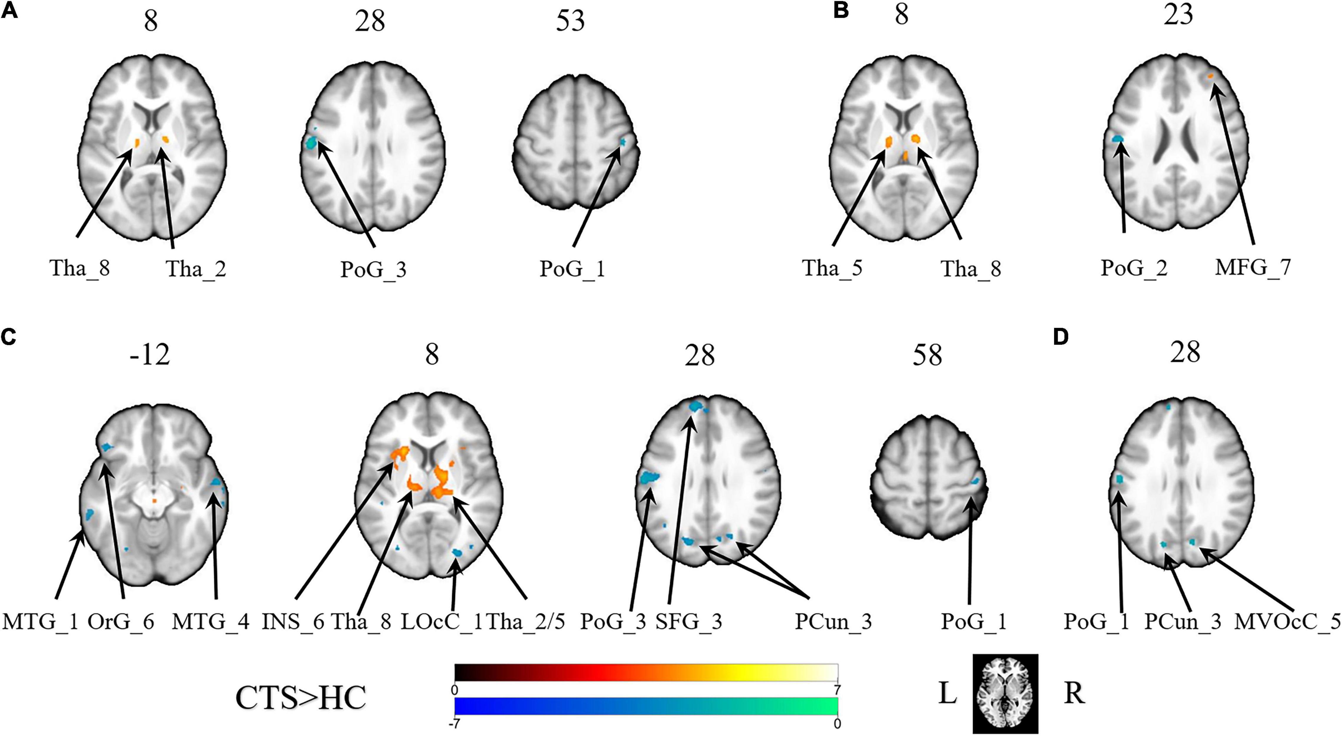 Frontiers | Dysfunction in the Interaction of Information