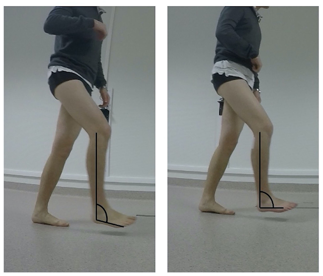 Frontiers Respective Contributions of Instrumented 3D Gait Analysis