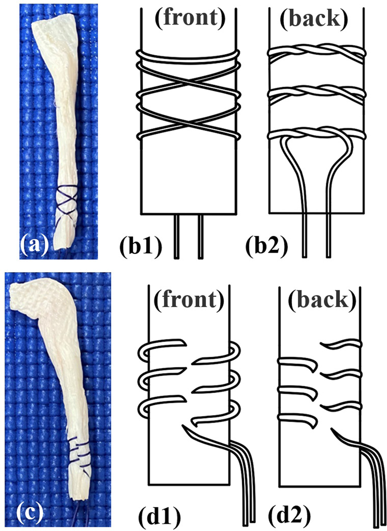 Advanced Knotting Techniques (Examples from Surgical Practice