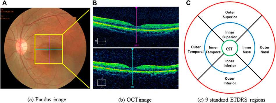 Frontiers Impact of High-Altitude Hypoxia on Bone Defect Repair