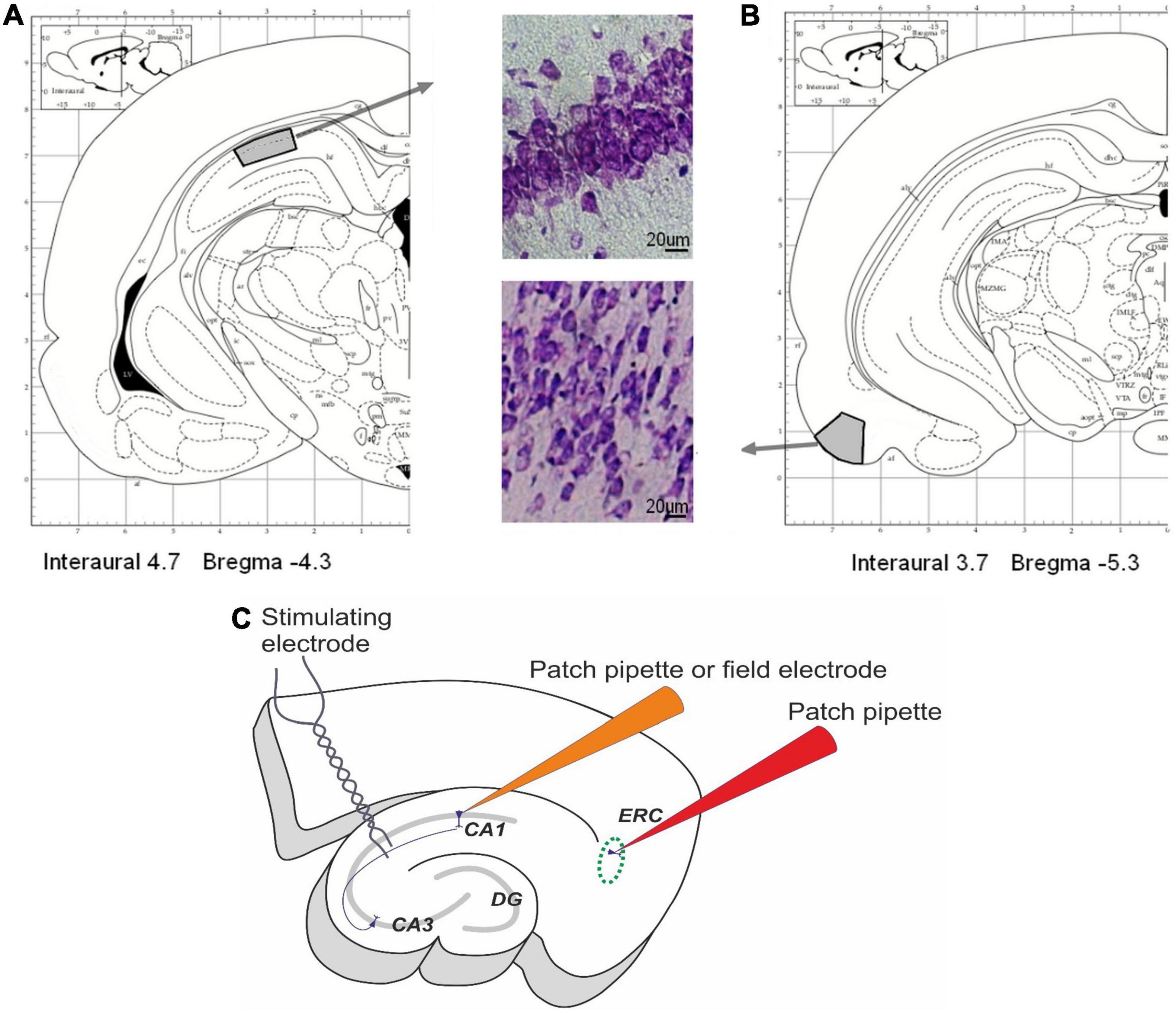 Frontiers | Maternal Hypoxia Increases the Excitability of