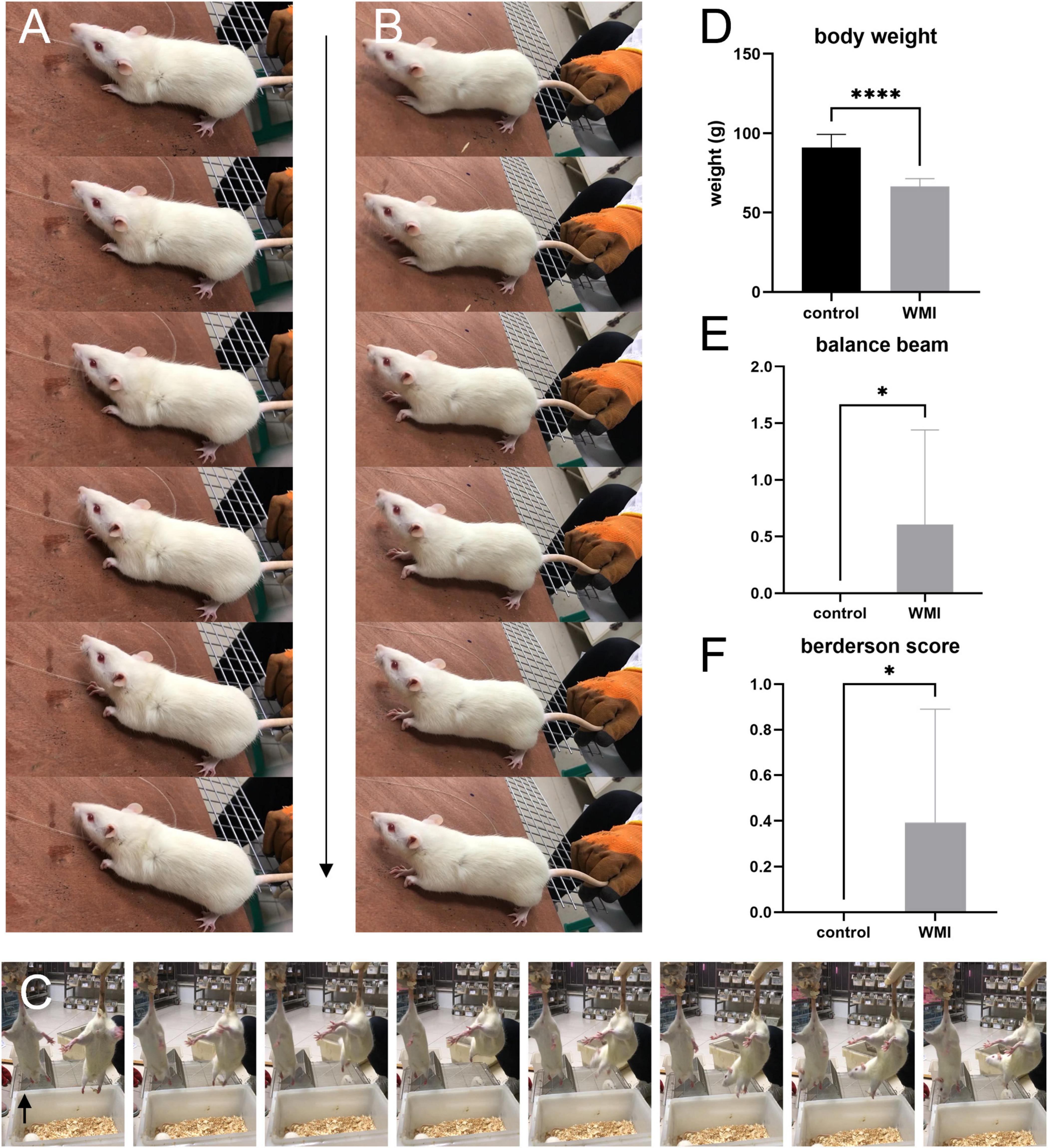 Frontiers | Multi-Hit White Matter Injury-Induced Cerebral Palsy 