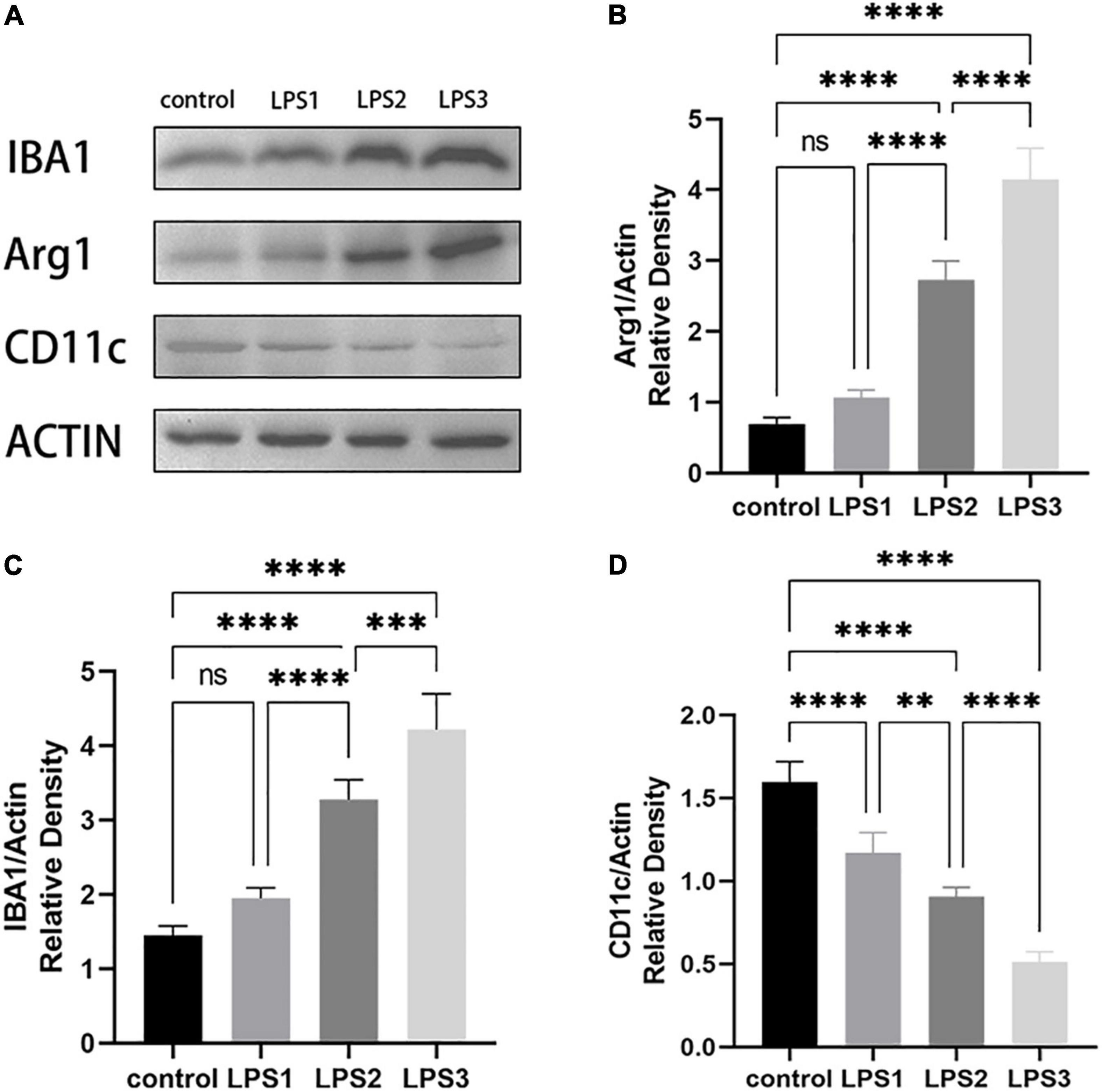 Frontiers | Multi-Hit White Matter Injury-Induced Cerebral Palsy 