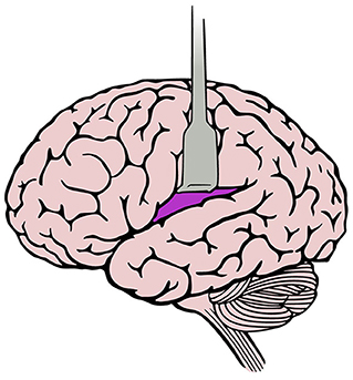 Figure 2 - Illustration of the human brain (left side is the front, and the right side is the back).