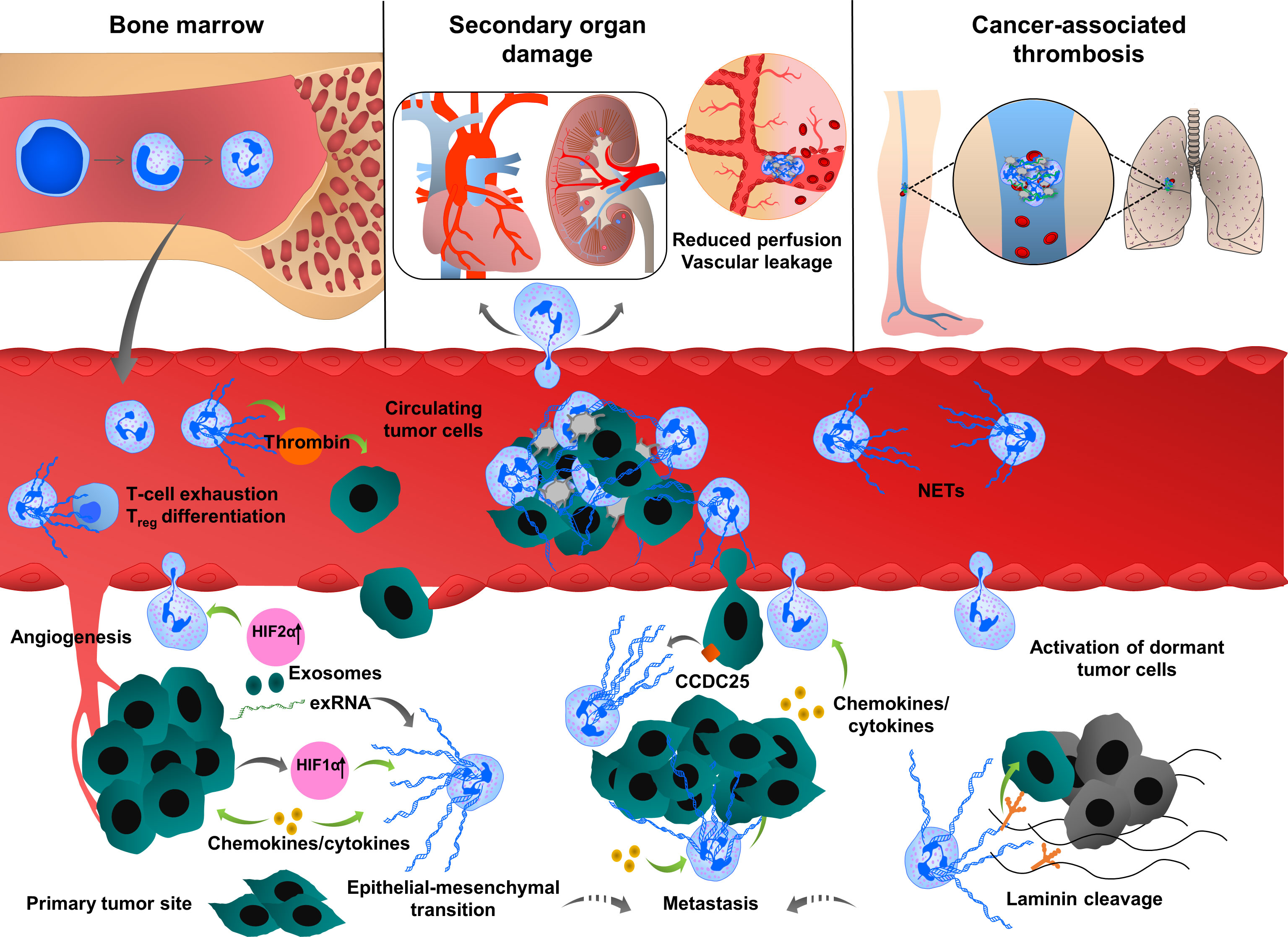 Frontiers | Extracellular DNA Traps: Origin, Function and Implications for  Anti-Cancer Therapies