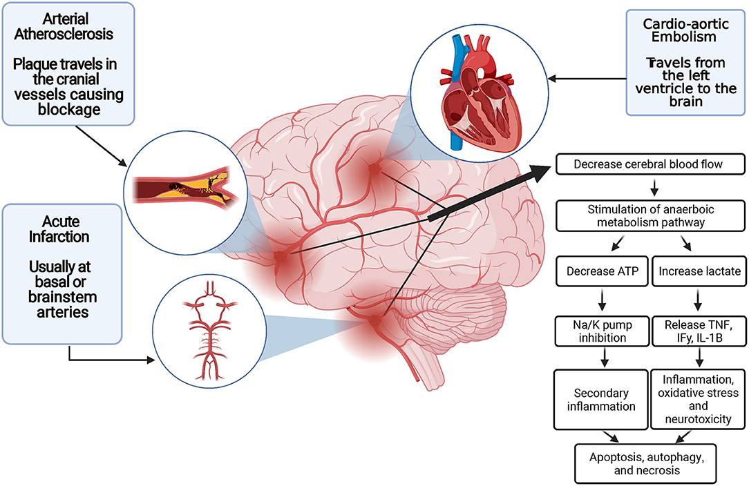 Neuroprotection. Neuroprotection affect.