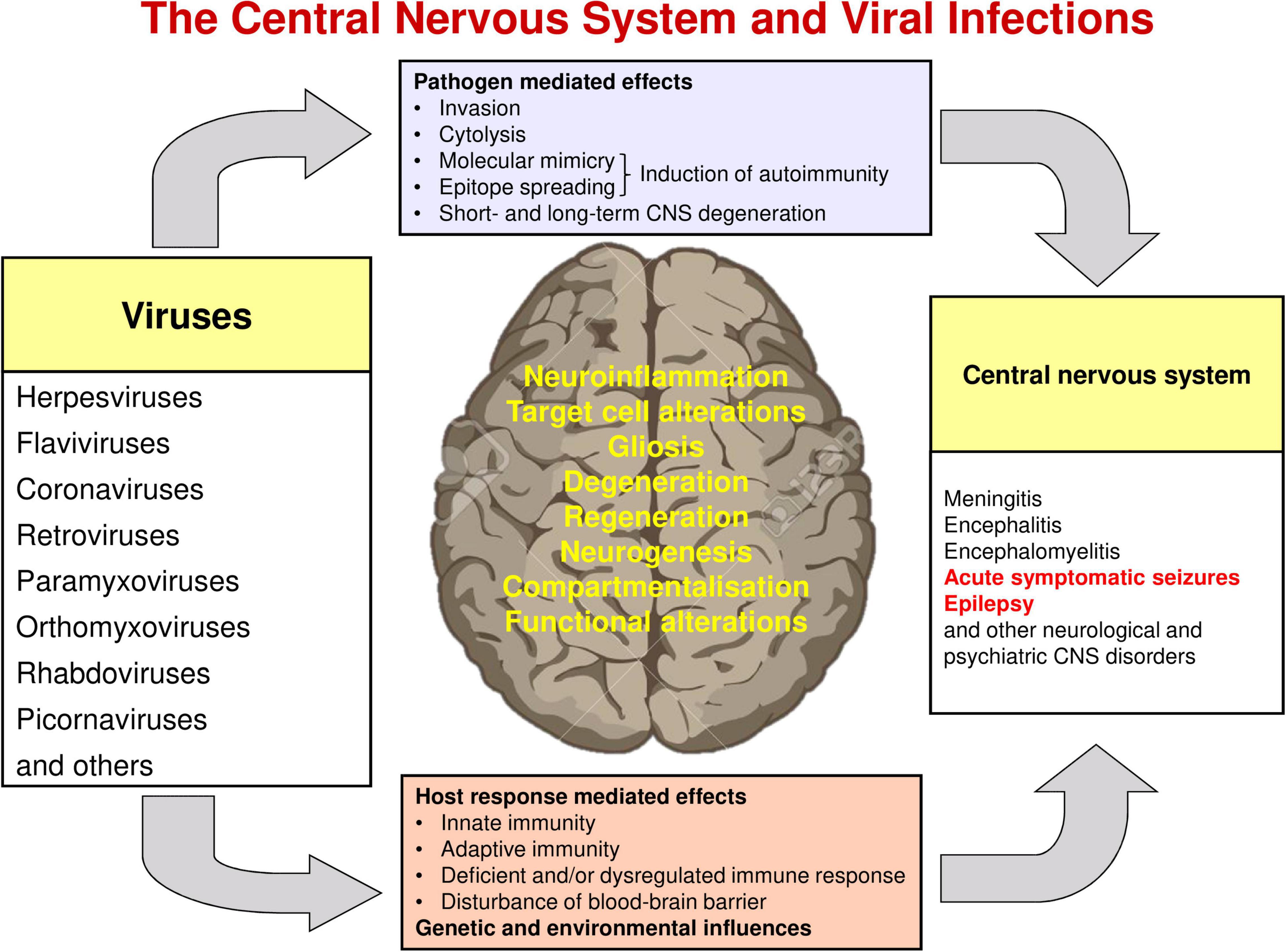 Epilepsy Brain Diagram