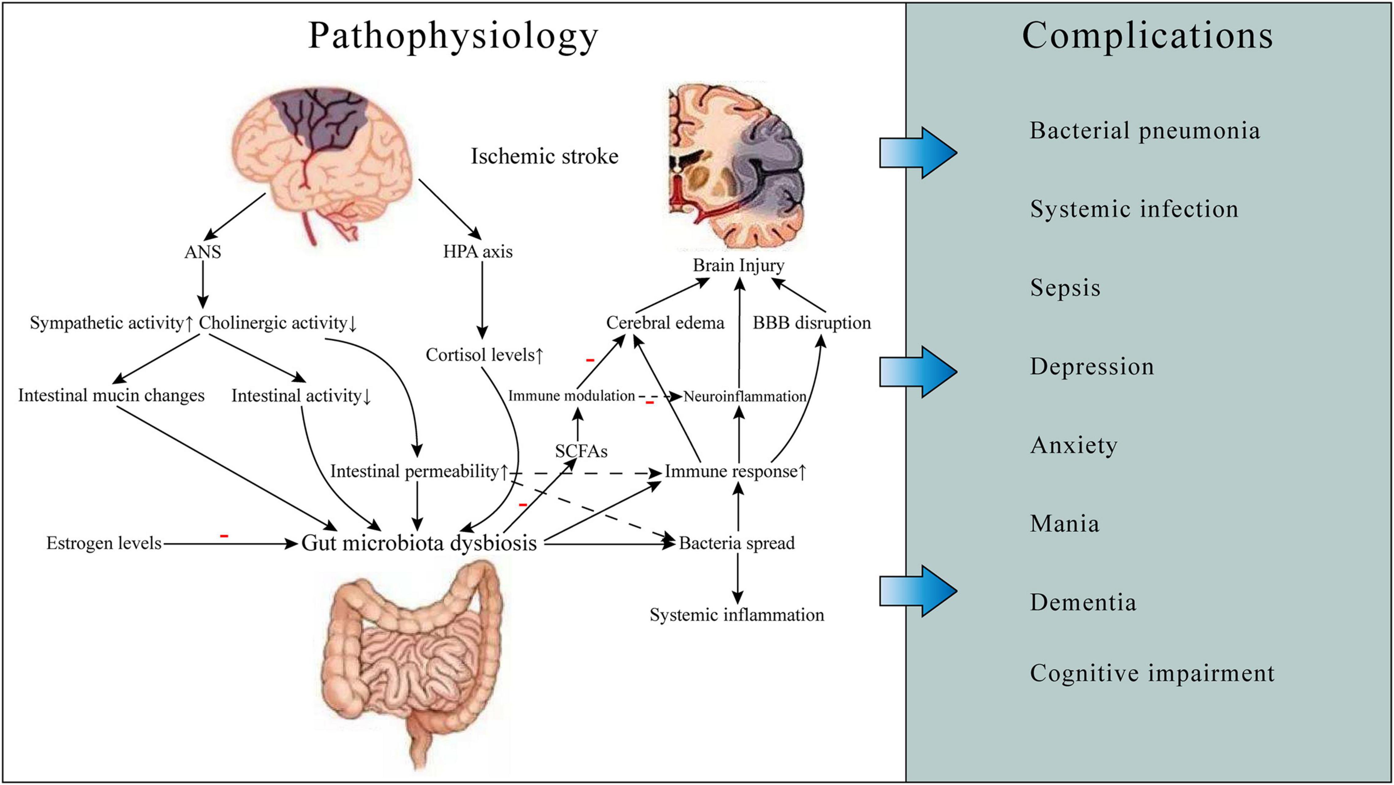 ischemic stroke pathophysiology