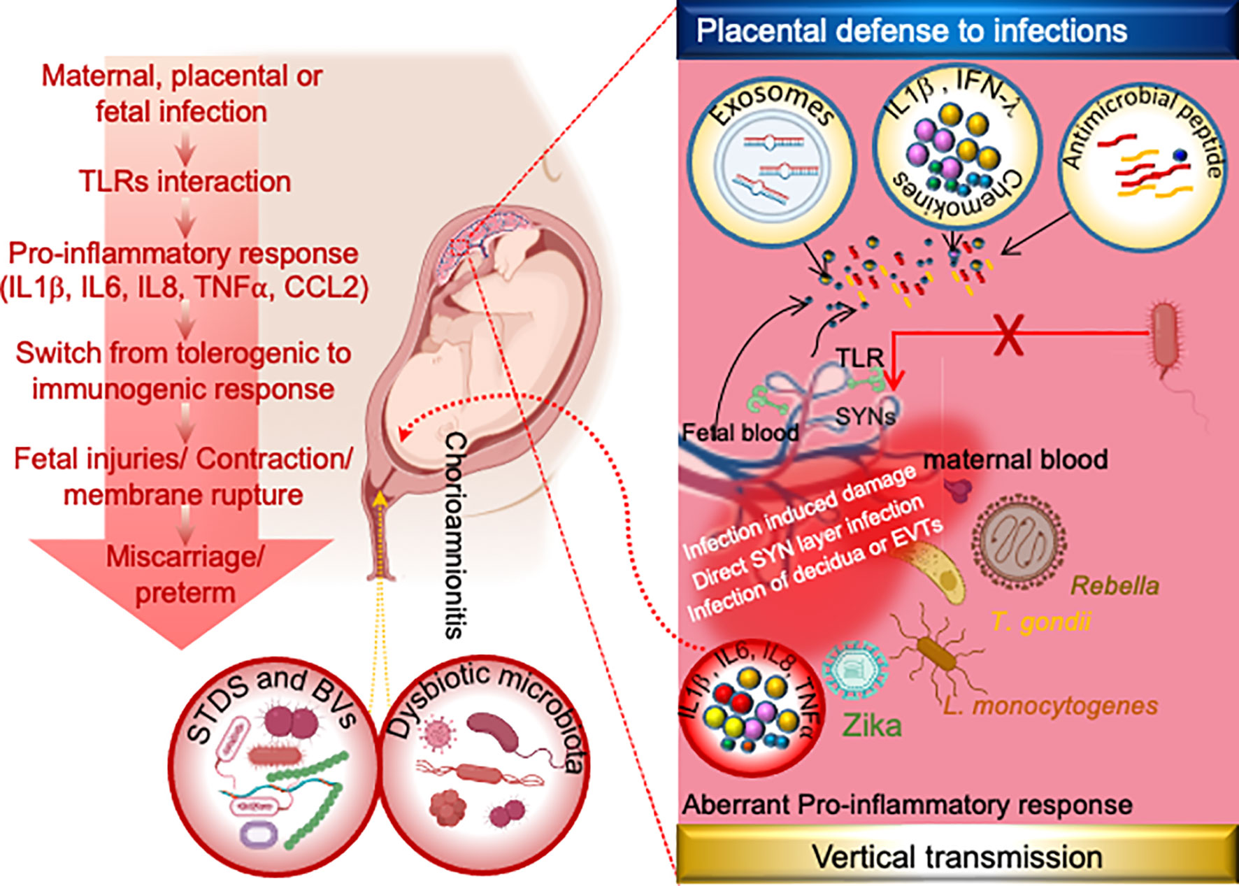 Frontiers  Incidence of postpartum infections and outcomes