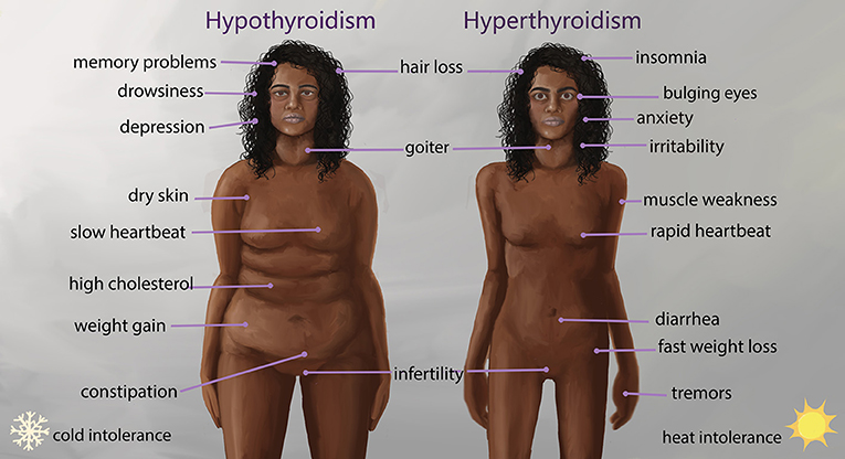 Figure 3 - Hypothyroidism and hyperthyroidism have symptoms that involve many organs and body systems.
