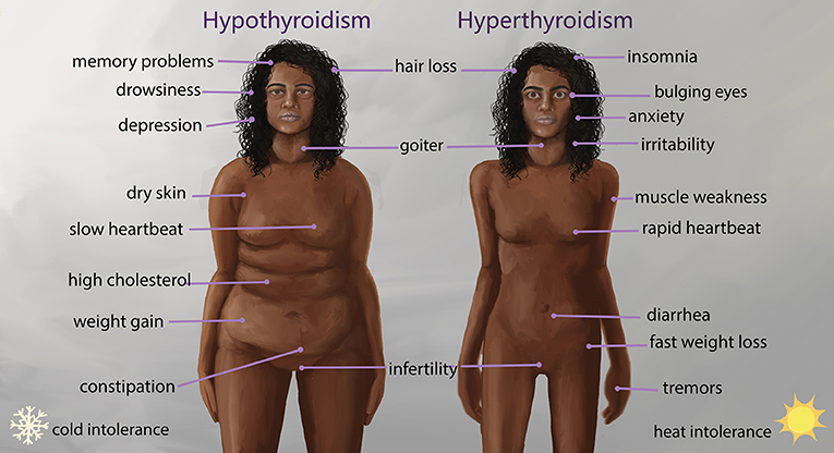 Figure 3 - Hypothyroidism and hyperthyroidism have symptoms that involve many organs and body systems.