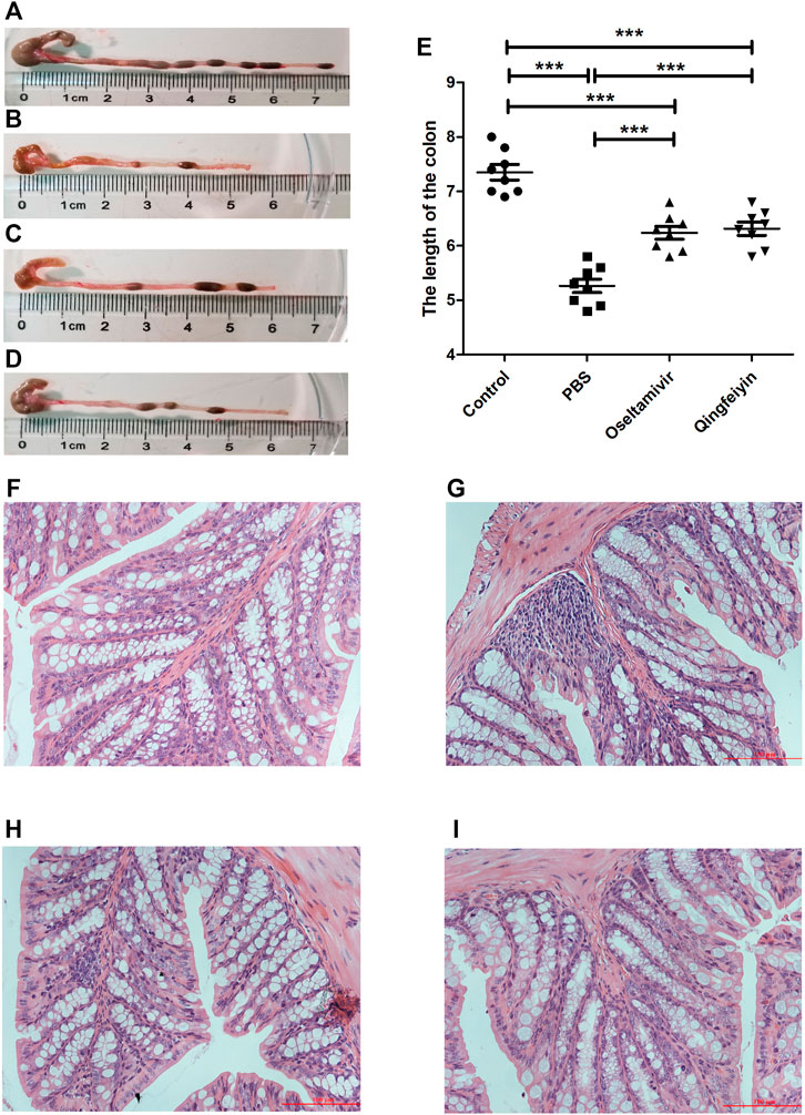 Frontiers | Qingfeiyin Decoction Inhibits H1N1 Virus ...