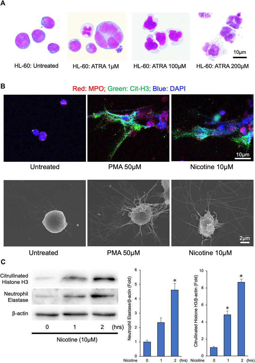 Frontiers The Significance of Neutrophil Extracellular Traps in