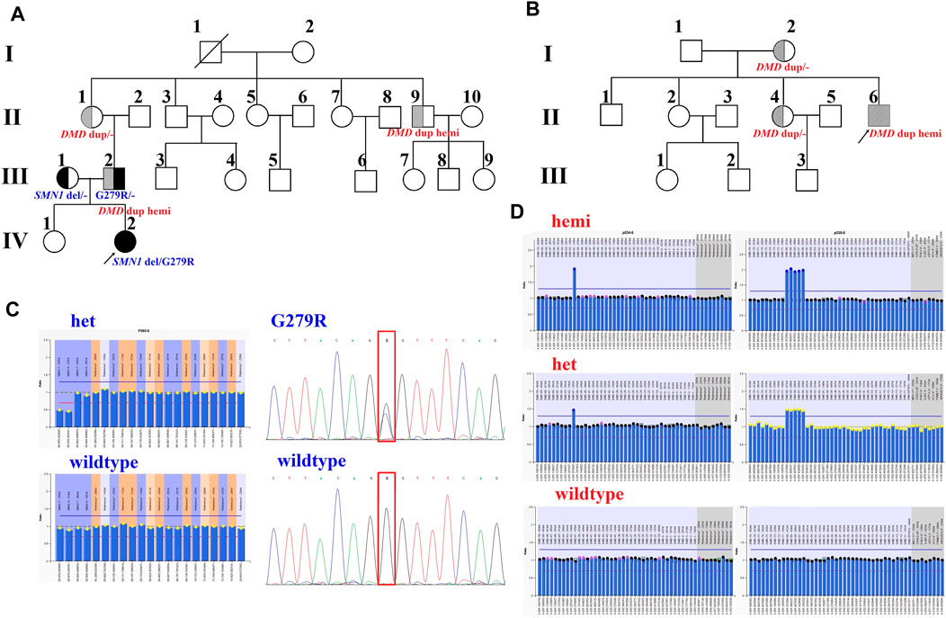 Screening for Tay‐Sachs disease carriers by full‐exon sequencing