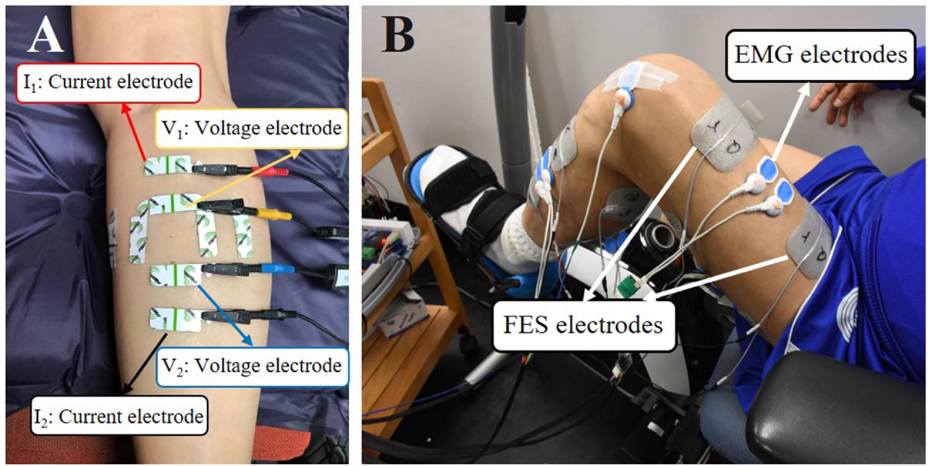 Top Applications of an Electric Pulse Muscle Stimulator in Surgical Therapy  -News