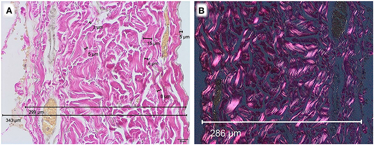 Frontiers | Industrial Processing Induces Pericardial Patch