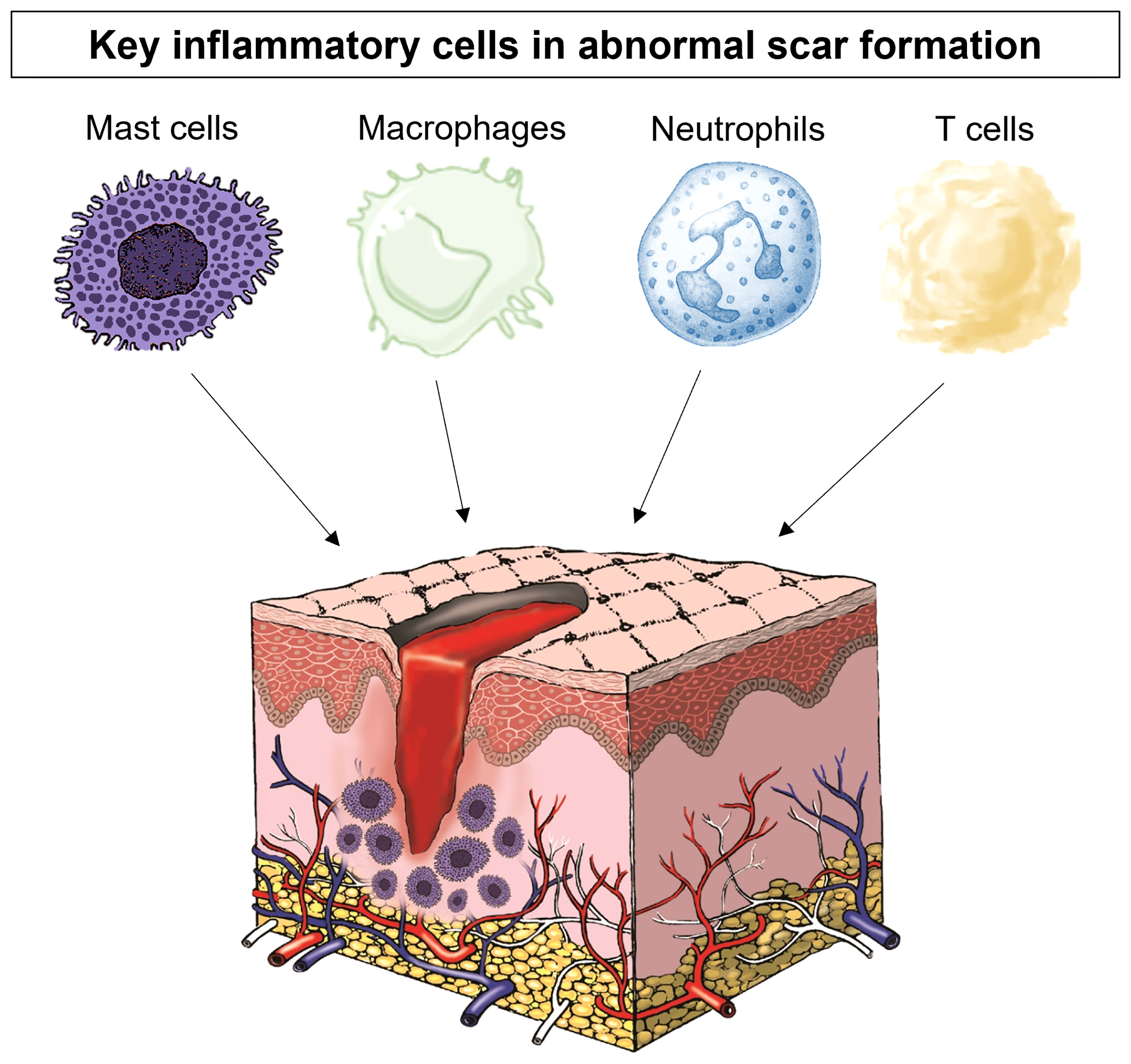 Frontiers  Inflammation and immune cell abnormalities in