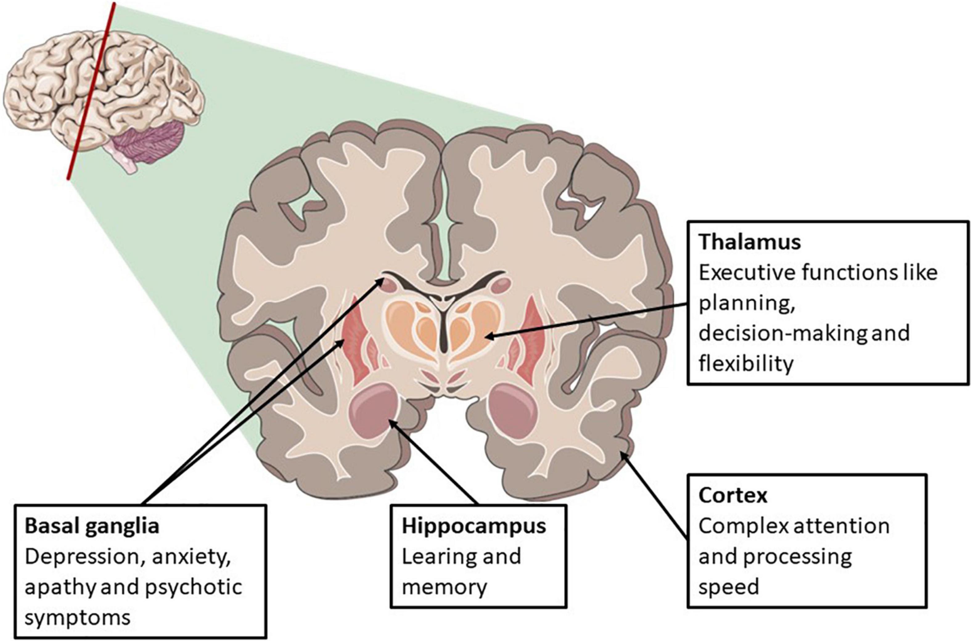 Frontiers Long Term Cognitive Function After Cardiac Arrest A Mini