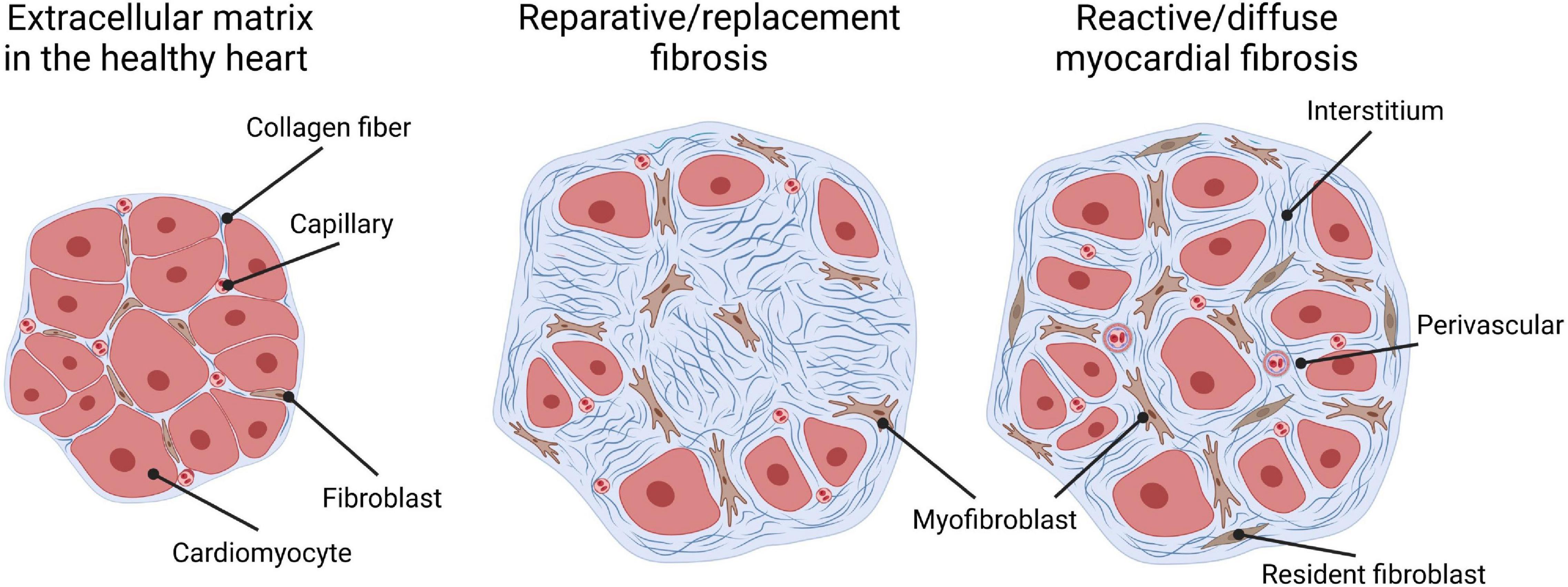 interstitial fibrosis