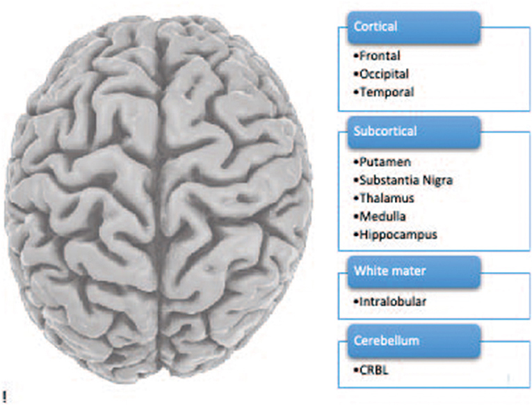 Figure 1 - The human brain including 10 brain regions.