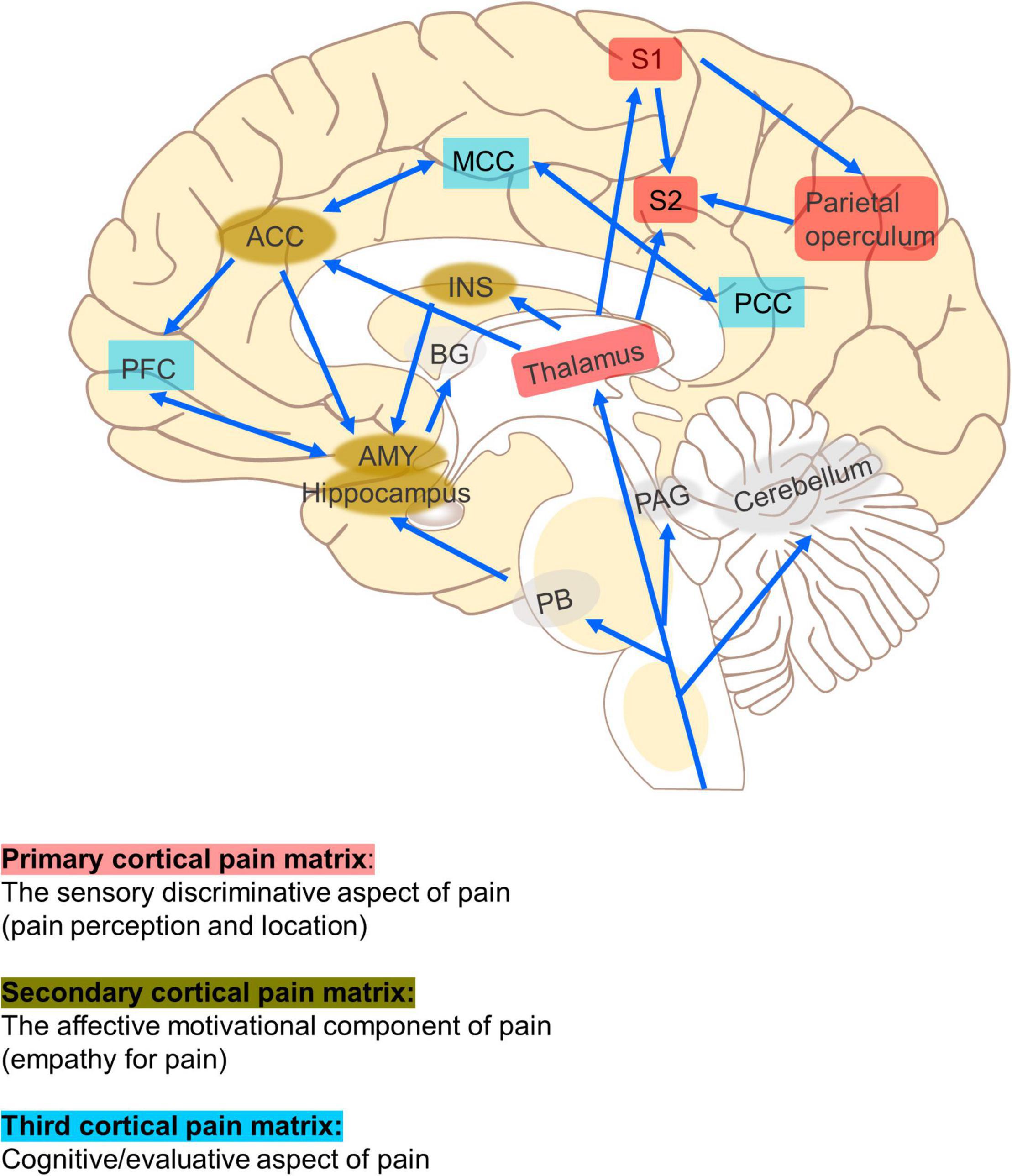 New type of nerve stimulation relieves chronic back pain