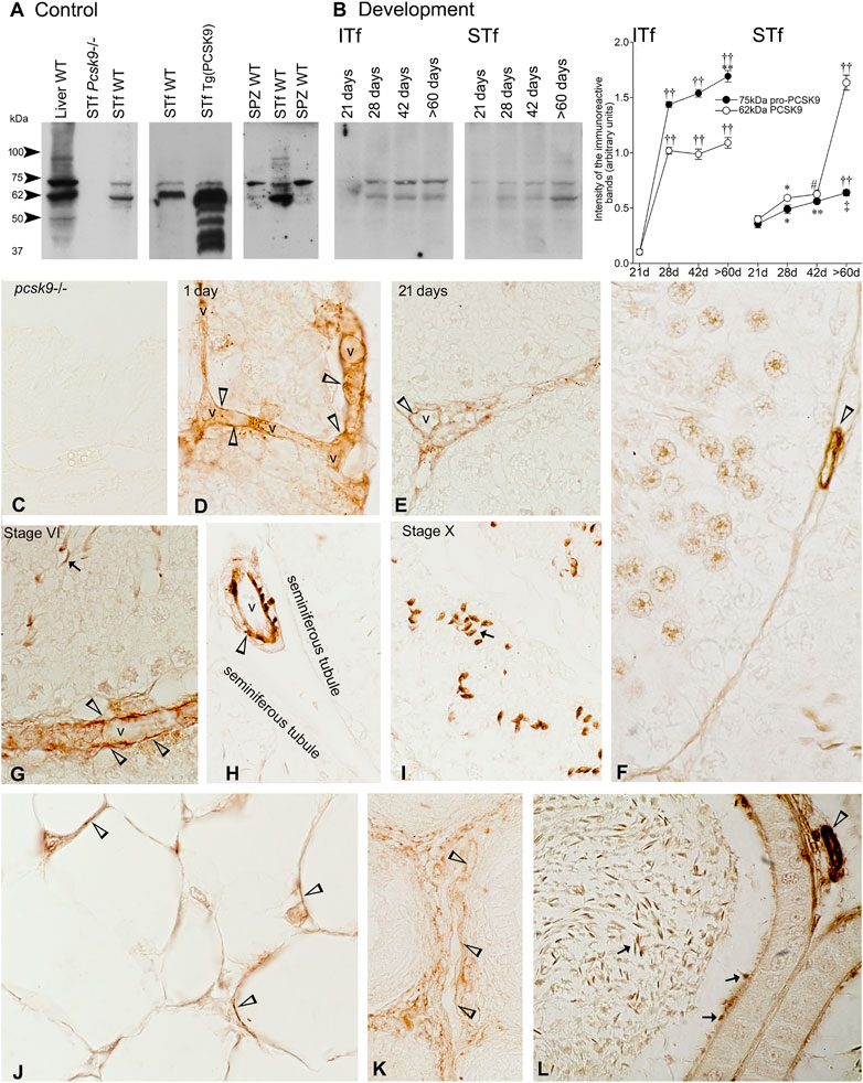 PDF) Insulin and IR-β in pig spermatozoa: A role of the hormone in